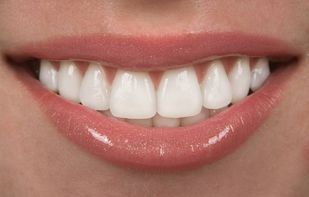 A close-up of a woman's cheerful smile, revealing her white teeth.